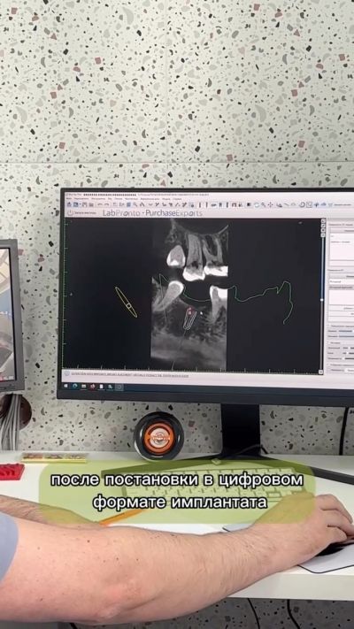 Дентальная компьютерная томография