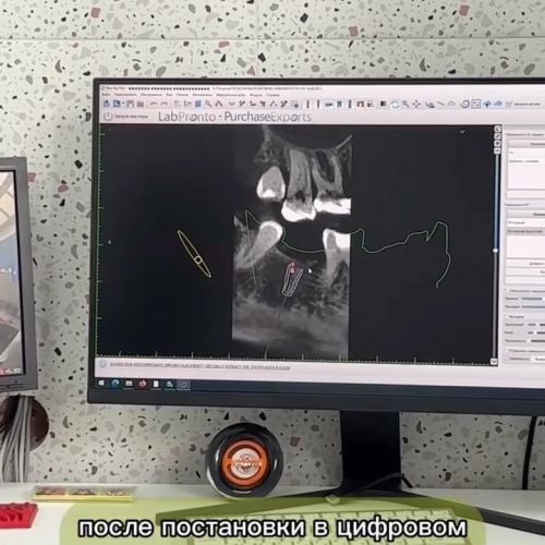 Дентальная компьютерная томография