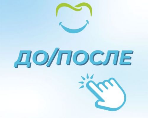 Очаг деструкции 3.5 зуба в области корня